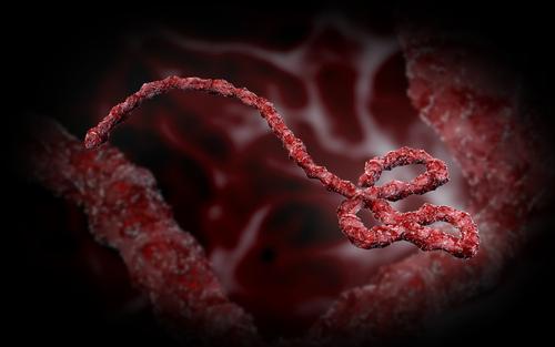 Ebola Virus Signs, Symptoms, Treatment And Prevention In Pakistan